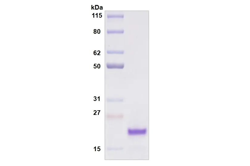 [MC11-050] Recombinant Human Siglec-8, His Tag -50 ug